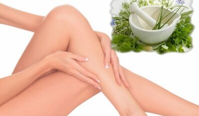 Treatment of varicose veins of lower limbs with folk remedies