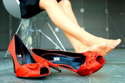 symptoms of varicose veins of the legs
