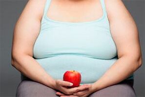 To cure varicose veins, you need to lose weight