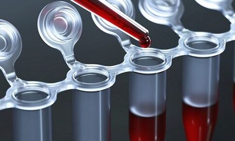 blood test for varicose veins on the legs