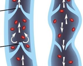 functioning of the valvular apparatus of the veins of the lower limbs